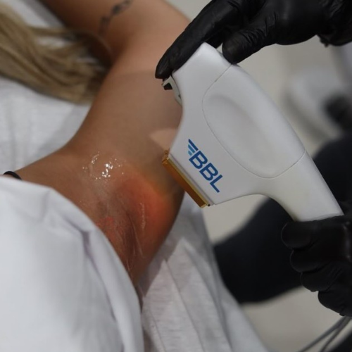 Package IPL hair removal sessions for 1 person - L'EXPÉRIENCE Beauté Urbaine available in Wellness - Coffrets Prestige - 1